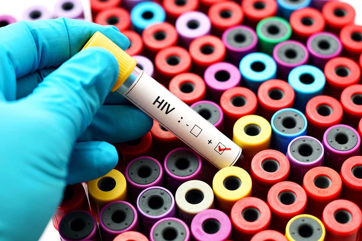 HIV report